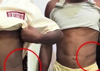 ‘I Was Shocked’: Mother Narrates How She Discovered Her Son’s Kidney Had Been Removed