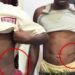 ‘I Was Shocked’: Mother Narrates How She Discovered Her Son’s Kidney Had Been Removed