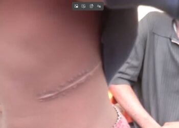 Police Arrest Nephrologists Over Alleged Organ-Harvesting Syndicate in Abuja, Nasarawa