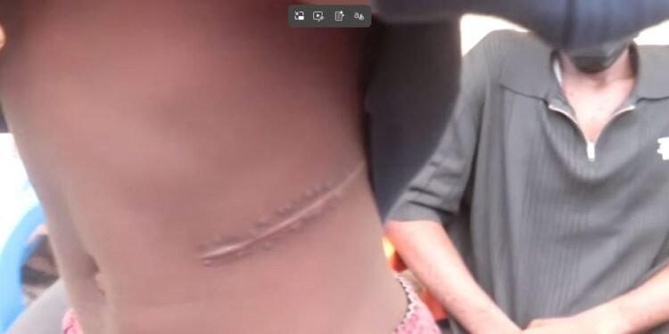 Police Arrest Nephrologists Over Alleged Organ-Harvesting Syndicate in Abuja, Nasarawa