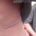 Police Arrest Nephrologists Over Alleged Organ-Harvesting Syndicate in Abuja, Nasarawa